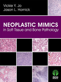 Imagen de portada: Neoplastic Mimics in Soft Tissue and Bone Pathology 1st edition 9781620700518