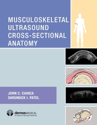 Cover image: Musculoskeletal Ultrasound Cross-Sectional Anatomy 1st edition 9781620700624
