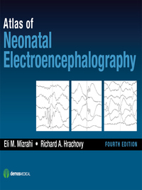 Titelbild: Atlas of Neonatal Electroencephalography 4th edition 9781620700679