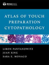 Cover image: Atlas of Touch Preparation Cytopathology 1st edition 9781620700686