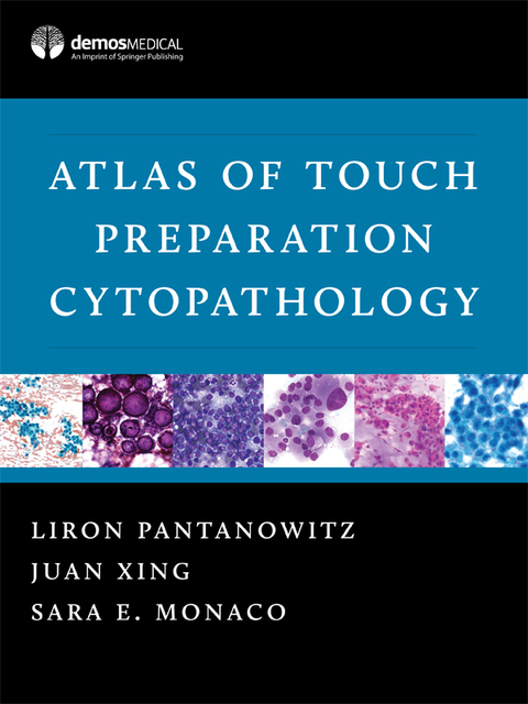 Atlas of Touch Preparation Cytopathology, 1st Edition - FULL INSTANT DOWNLOAD | PDF DOCX EPUB