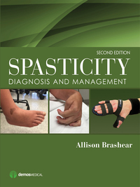 Cover image: Spasticity 2nd edition 9781620700723