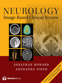 表紙画像: Neurology Image-Based Clinical Review 1st edition 9781620701034