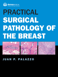 Omslagafbeelding: Practical Surgical Pathology of the Breast 1st edition 9781620701058