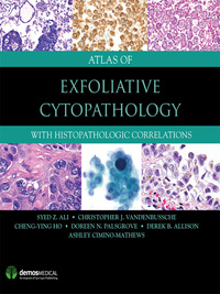 Titelbild: Atlas of Exfoliative Cytopathology 1st edition 9781620701102