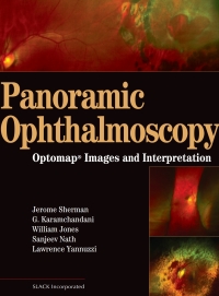 Cover image: Panoramic Ophthalmoscopy 9781556427800