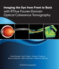 Cover image: Imaging the Eye from Front to Back with RTVue Fourier-Domain Optical Coherence Tomography 9781556429637