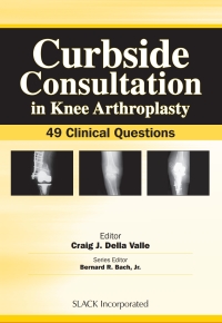 Cover image: Curbside Consultation in Knee Arthroplasty 9781556428241