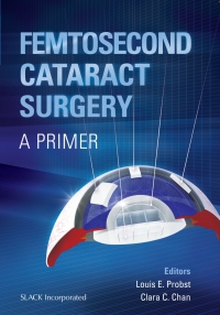 Titelbild: Femtosecond Cataract Surgery 9781617110498