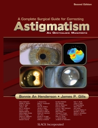 Imagen de portada: A Complete Surgical Guide for Correcting Astigmatism 9781556429354