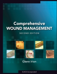Cover image: Comprehensive Wound Management, Second Edition 9781556428333