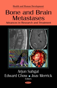 Imagen de portada: Bone and Brain Metastases: Advances in Research and Treatment 9781616683658