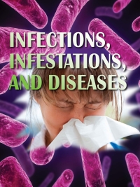 Cover image: Infections, Infestations, and Diseases 9781615905607