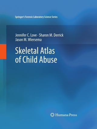 Cover image: Skeletal Atlas of Child Abuse 9781617792151