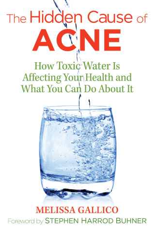 Cover image: The Hidden Cause of Acne 2nd edition 9781620557099