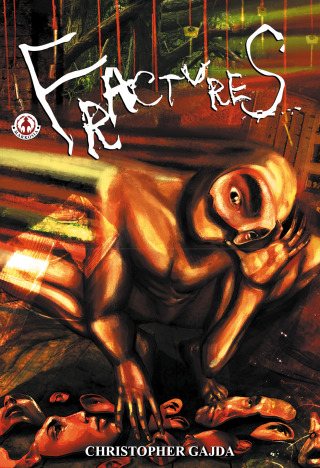 Imagen de portada: Fractures 9781905692392