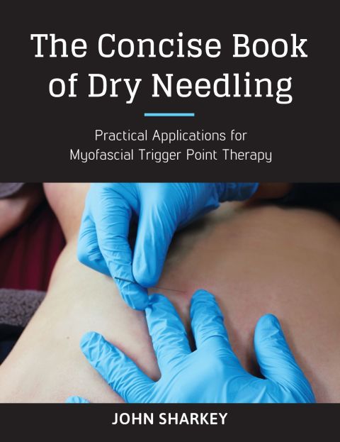 The Concise Book of Dry Needling: A Practitioner's Guide to Myofascial Trigger Point Applications - FULL INSTANT DOWNLOAD | PDF DOCX EPUB