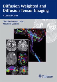 Cover image: Diffusion Weighted and Diffusion Tensor Imaging 1st edition 9781626230217
