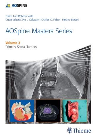Cover image: AOSpine Masters Series, Volume 2: Primary Spinal Tumors 1st edition 9781626230477