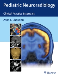 Cover image: Pediatric Neuroradiology 1st edition 9781626230965