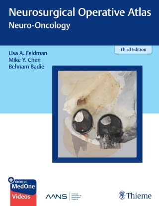 Imagen de portada: Neurosurgical Operative Atlas: Neuro-Oncology 3rd edition 9781626231085