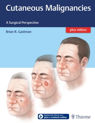 Cover image: Cutaneous Malignancies 1st edition 9781626231474