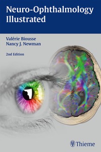 Cover image: Neuro-Ophthalmology Illustrated 2nd edition 9781626231504