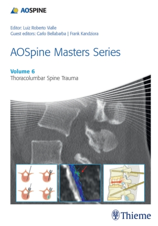 表紙画像: AOSpine Masters Series, Volume 6: Thoracolumbar Spine Trauma 1st edition 9781626232259