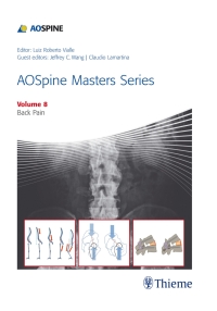 表紙画像: AOSpine Masters Series, Volume 8: Back Pain 1st edition 9781626232297