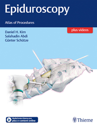 Cover image: Epiduroscopy 1st edition 9781626232662