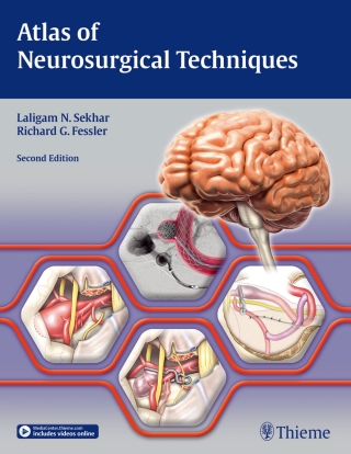 Imagen de portada: Atlas of Neurosurgical Techniques 2nd edition 9781626233881