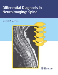 Imagen de portada: Differential Diagnosis in Neuroimaging: Spine 1st edition 9781626234772