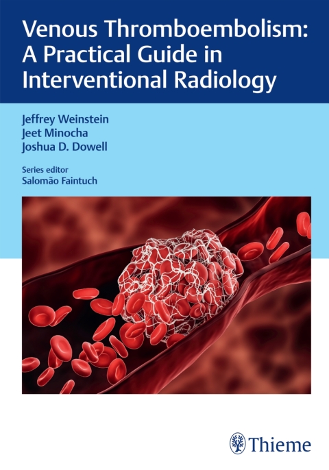 Venous Thromboembolism: A Practical Guide in Interventional Radiology, 1st Edition - FULL INSTANT DOWNLOAD | PDF DOCX EPUB