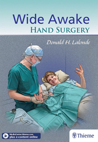 Cover image: Wide Awake Hand Surgery 1st edition 9781626236622