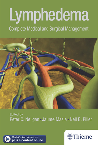 Cover image: Lymphedema 1st edition 9781626236714