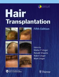 Cover image: Hair Transplantation 5th edition 9781626235700