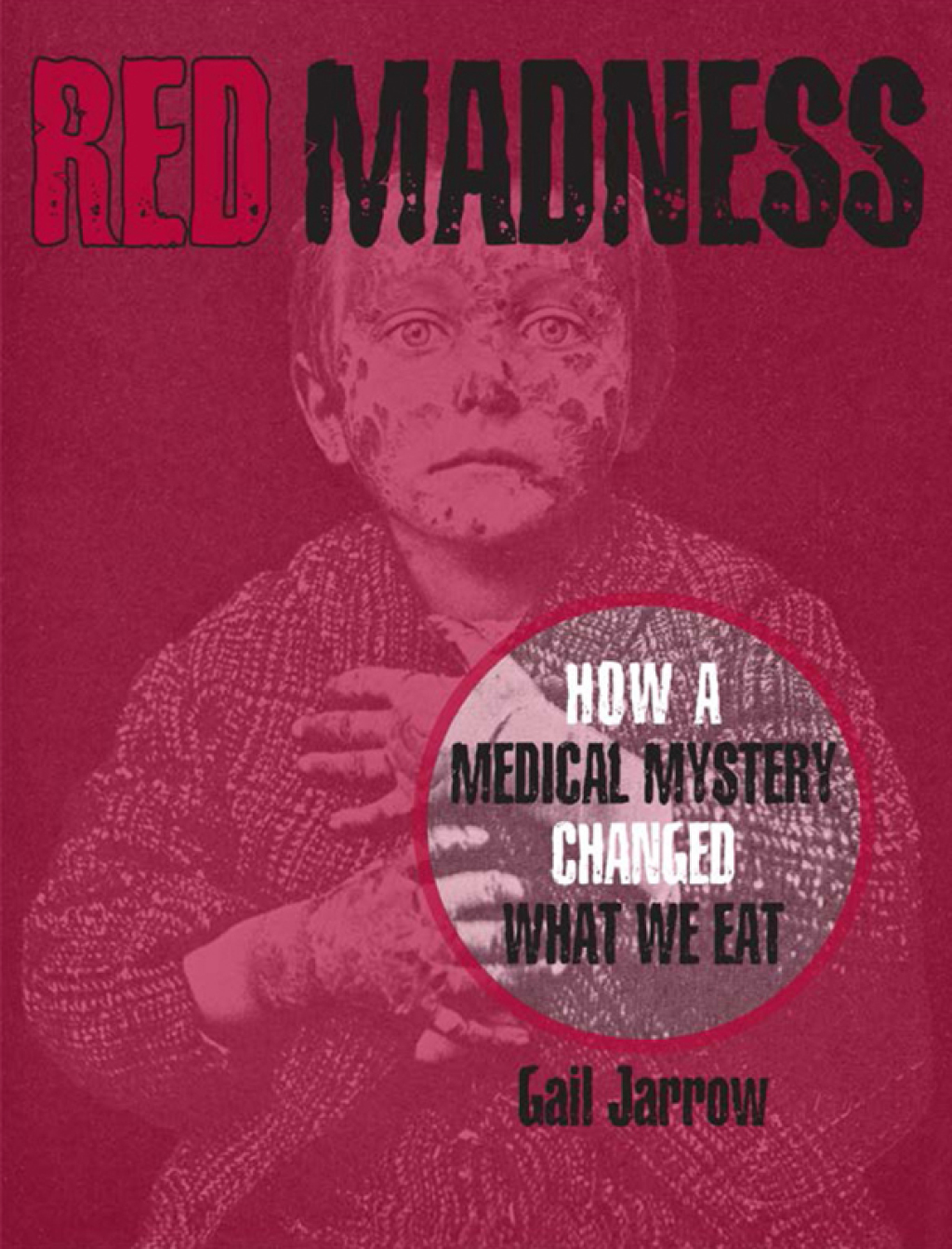 Red Madness How a Medical Mystery Changed What We Eat