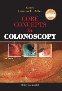 Cover image: Core Concepts in Colonoscopy 9781617116148