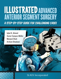 Cover image: Illustrated Advanced Anterior Segment Surgery 9781630911843