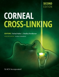 Cover image: Corneal Cross-Linking, Second Edition 9781630912109