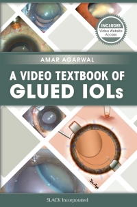 صورة الغلاف: A Video Textbook of Glued IOLs 9781630912246