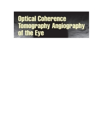 Imagen de portada: Optical Coherence Tomography Angiography of the Eye 9781630912826