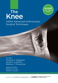 Cover image: The Knee 9781617119996