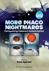 صورة الغلاف: More Phaco Nightmares 9781630914394