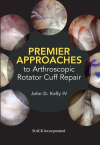 Cover image: Premier Approaches to Arthroscopic Rotator Cuff Repair 9781630915629