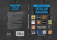Cover image: Principles of Ocular Imaging 9781630915995