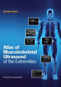 Omslagafbeelding: Atlas of Musculoskeletal Ultrasound of the Extremities 9781630916022