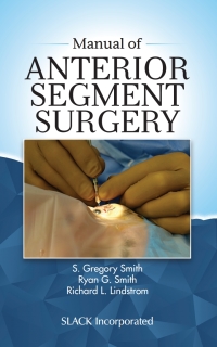Omslagafbeelding: Manual of Anterior Segment Surgery 9781630916206