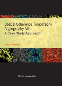 Cover image: Optical Coherence Tomography Angiography Atlas 9781630916411