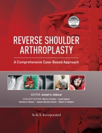 Cover image: Reverse Shoulder Arthroplasty 9781630916855